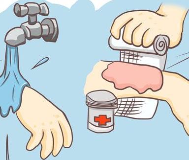 烫伤了怎么办最快解决方法,烫伤了怎么办动画