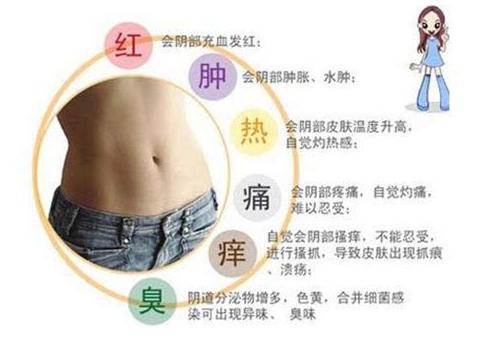 妇科里面痒怎么办,妇科痒的急救方法