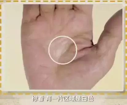 手的颜色能看出健康的问题吗,手是健康的镜子