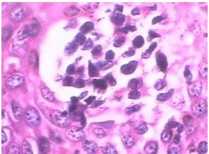 妇科里面痒怎么办,妇科痒的急救方法