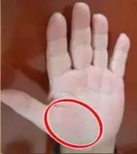 手的颜色能看出健康的问题吗,手是健康的镜子