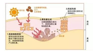 想要美白用什么成分,想要美白的你必须懂的一些知识