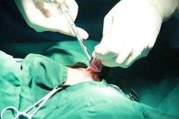 妇科上环7年了取了环会怀孕吗,妇科主任取环