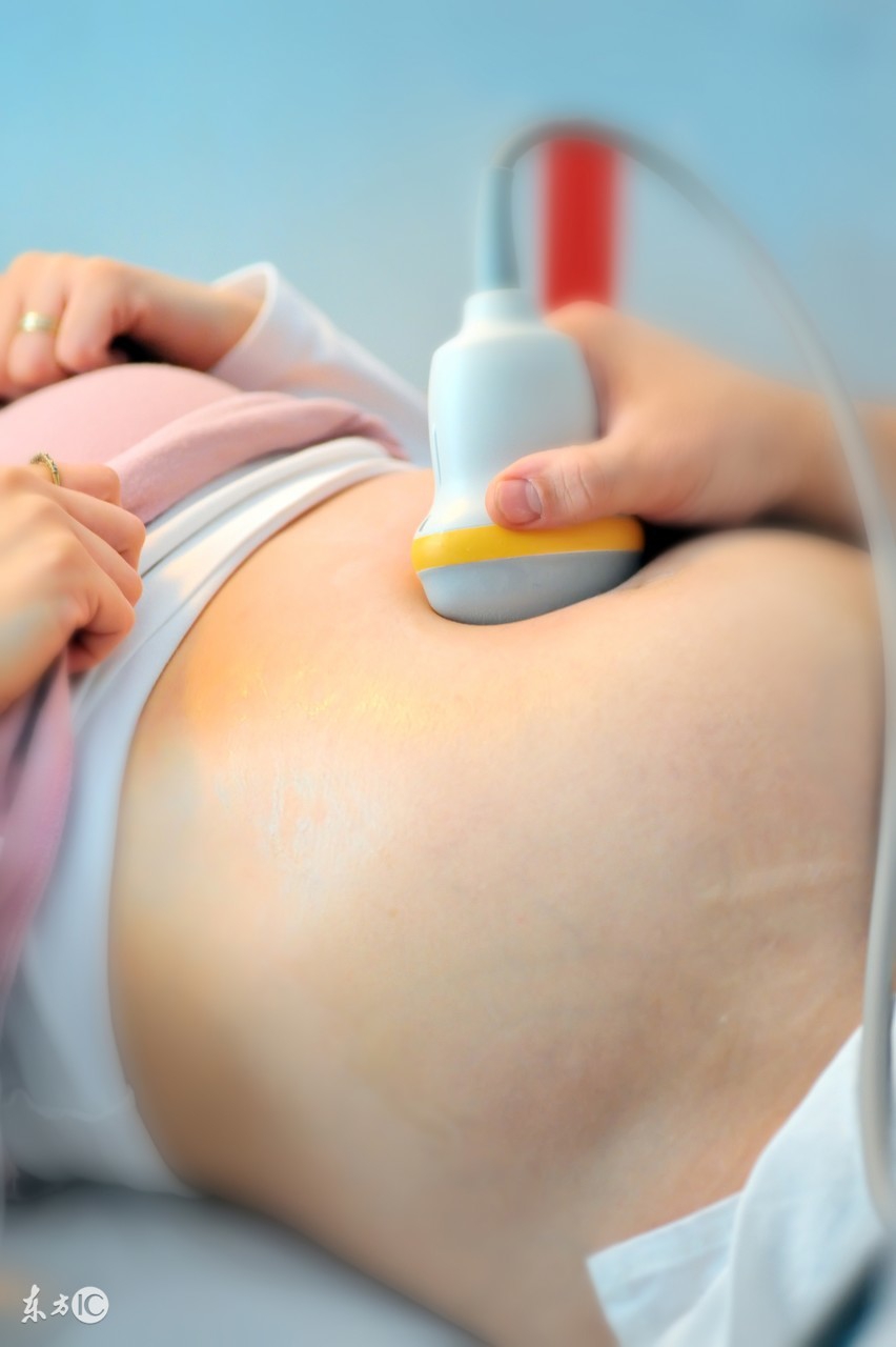 预约三维彩超,二胎时代超声波检查