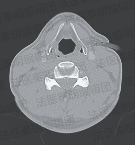 我们真的不想在假期开始前来一期重口味更新的