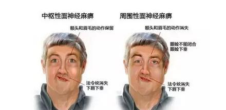 全国治半边瘫排名第一的医院,有专治半边瘫的医院吗