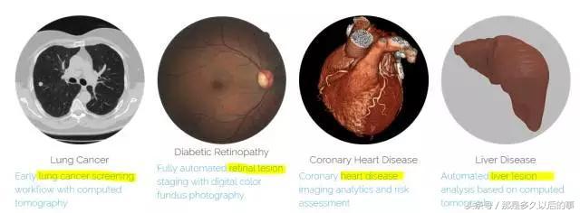 腾讯砸1亿投下这家AI医疗公司，这个新风口开启前的医疗创业寒冬