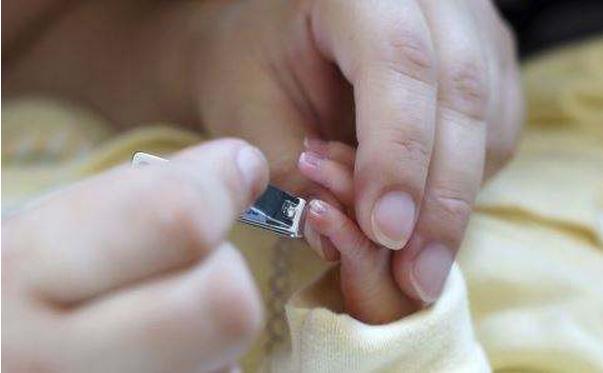 小月龄宝宝剪指甲甲沟炎,宝宝剪指甲出现甲沟炎怎么办