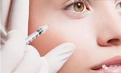 当青春变成了鱼尾纹,青春鱼尾纹