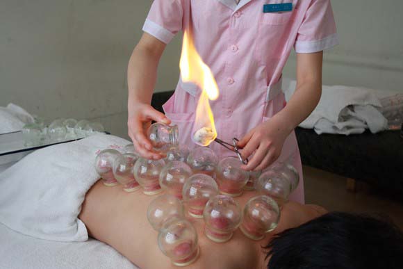 中医拔罐疗法的临床应用,中医拔罐疗法为什么是安全的