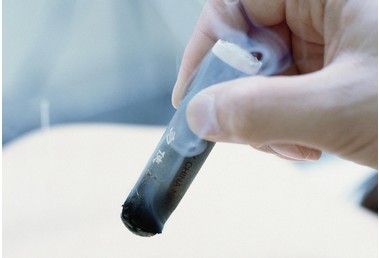 艾灸灸过的反应,艾灸后灸痕分析