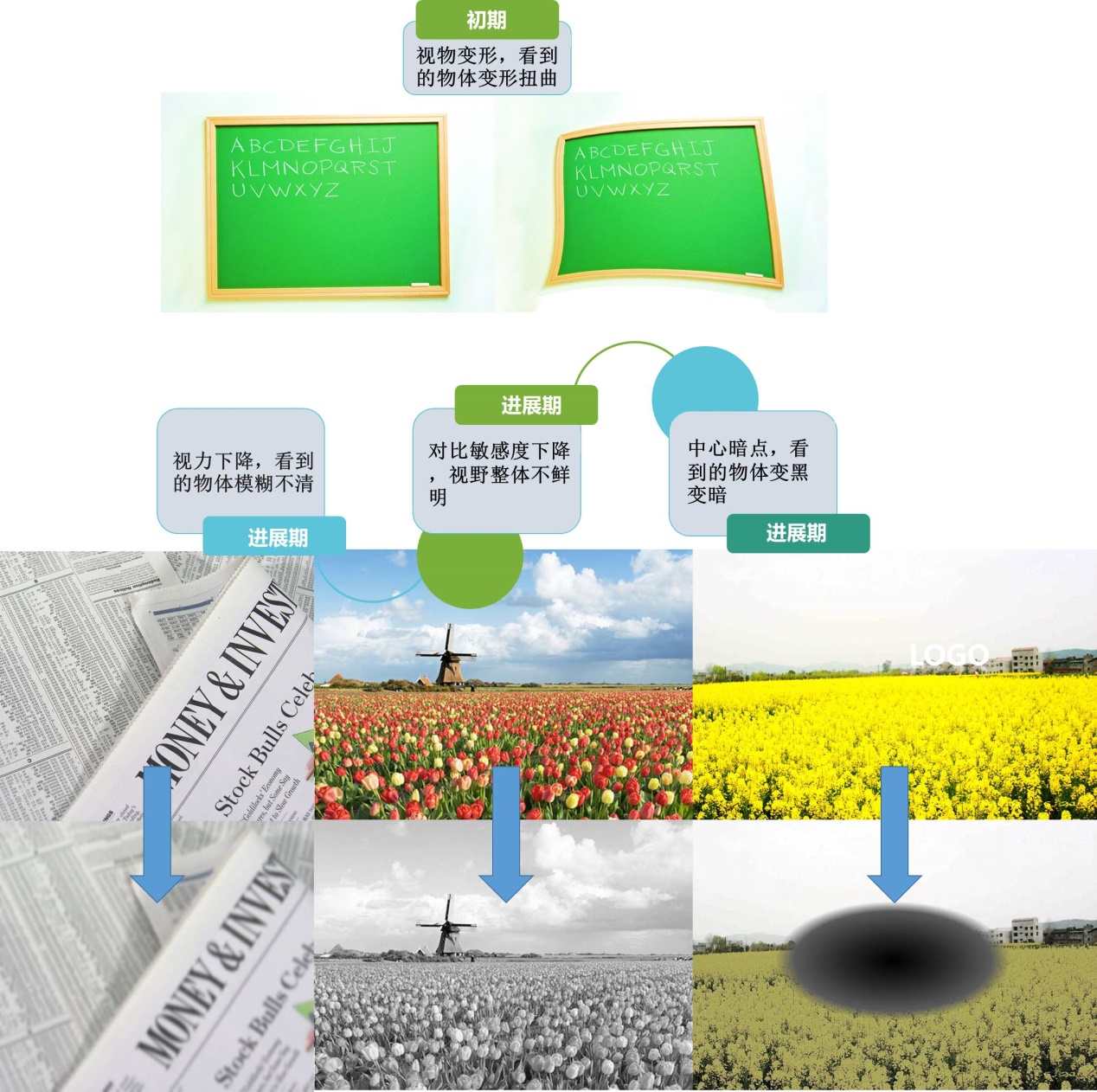 得了黄斑病变还能玩手机,得了黄斑病症状