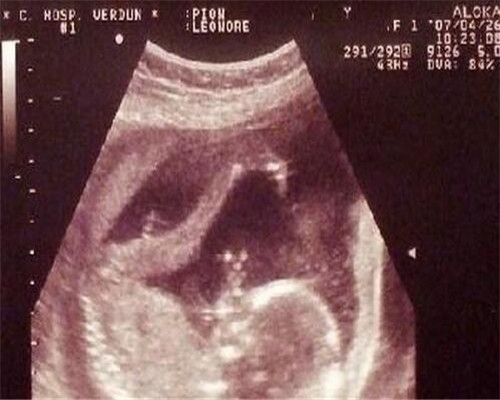 提高自己透过现象看本质的能力,透过现象看本质透过业务看政治