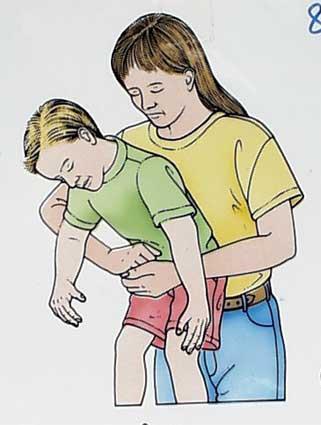 异物卡喉的急救方法婴儿,孕妇异物卡喉窒息时该怎么急救