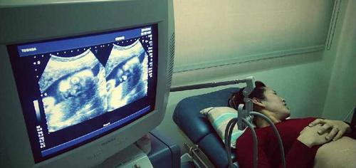 女人生娃后的心路历程,女性怀孕生育艰辛