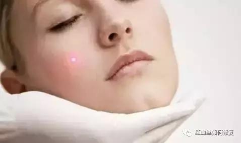 朵嘉浓晓晓敏感肌肤可以美白吗,朵嘉浓晓晓敏感肌肤能美白吗