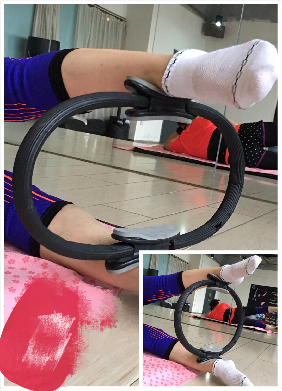 o型腿矫正训练,o型腿怎么矫正健身