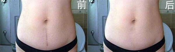 深扒热门贵妇面霜,深扒网红抗老成分真的这么有效吗