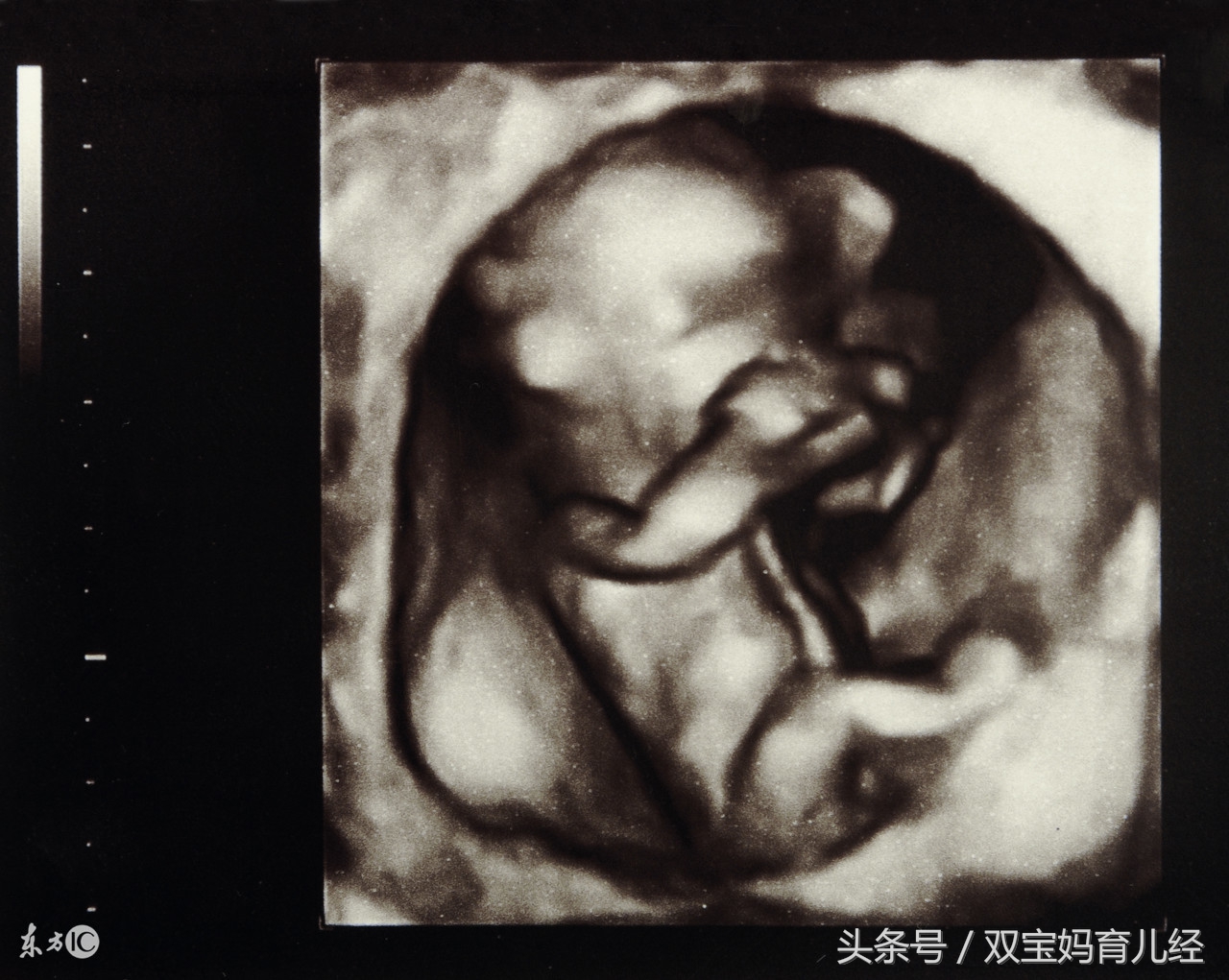 孕妈妈第一次被宝宝踢肚子,宝宝肚子被踢了一脚要紧吗