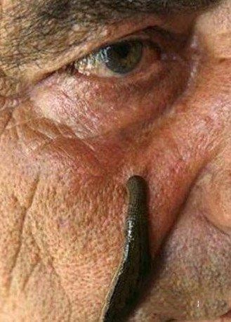 世界上有哪些能治病的方法,在中国有什么奇怪治病方法