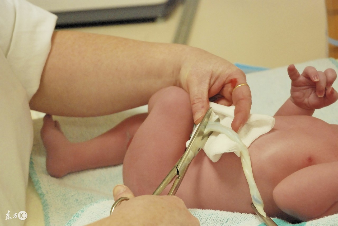 新生儿脐带在家怎么处理不感染,新生儿脐带护理预防新生儿脐炎