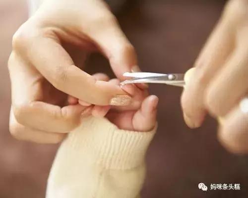 宝宝长倒刺要拔掉吗,宝宝长倒刺可以剪嘛