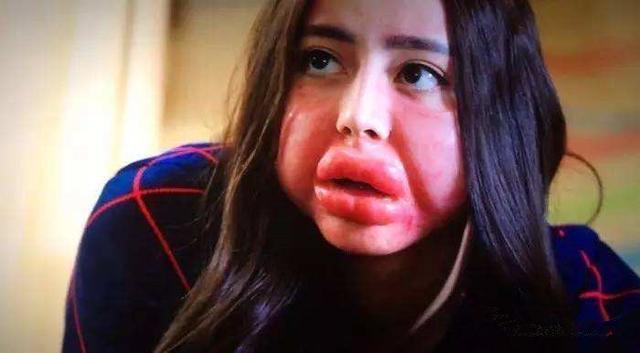 女星毁容戏,赵丽颖毁容电视剧