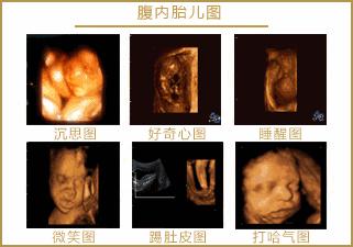 孕期超声知识app,孕期超声那些事ppt