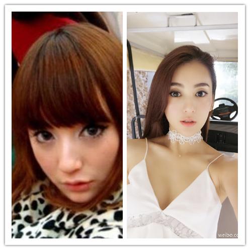 全网整容最成功的网红,全网前十网红整容