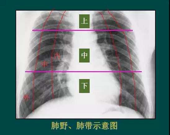 读完该文,让你学会如何看胸片