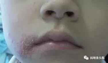 黄帝内经眼袋描述,黄帝内经中讲怎样让眼袋去掉