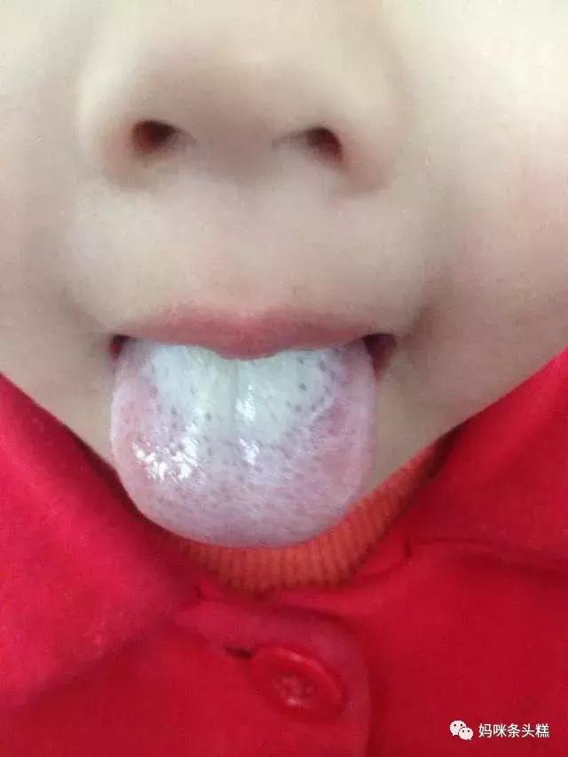 黄帝内经眼袋描述,黄帝内经如何治疗眼袋下垂