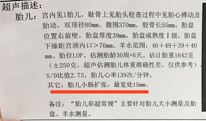 怀孕26周四维检查医生说小肠扩张,肠管扩张的宝妈