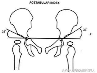 腿纹不对称的宝宝不会爬吗,腿纹不对称家长千万别忽视