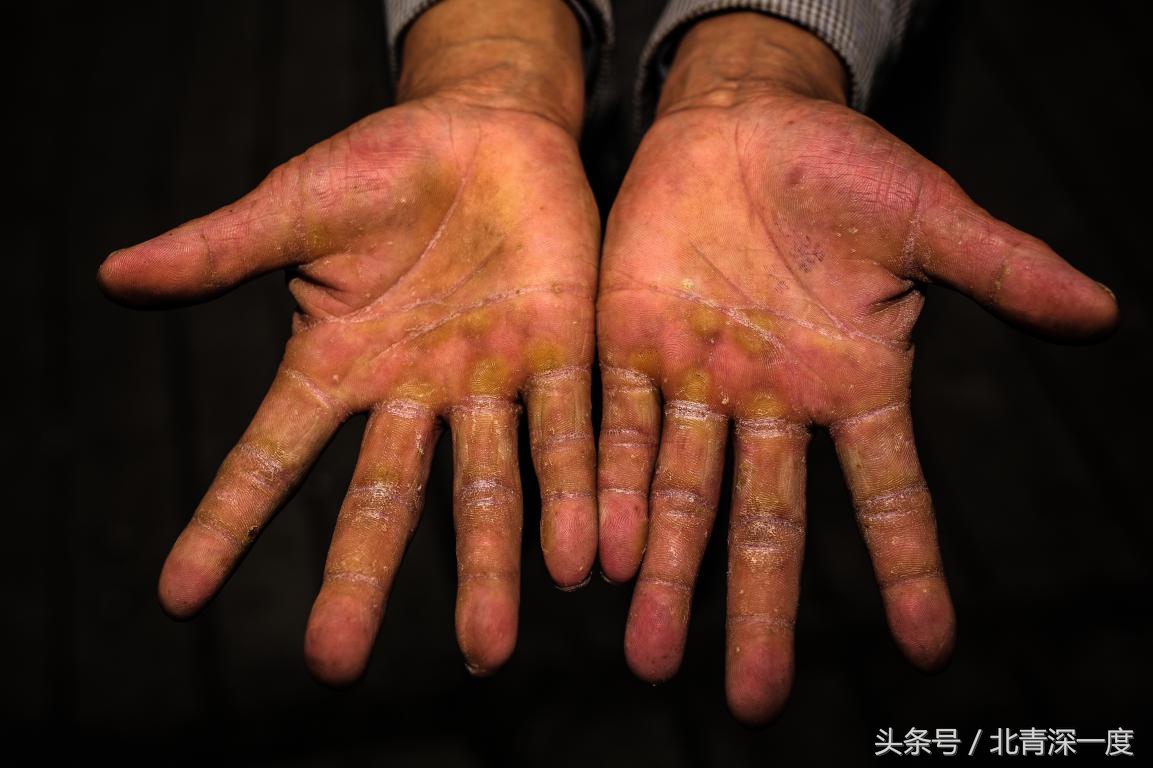 “鹿晗”在泥坑，妈妈在远方，你习以为常的幸福对他们却遥不可及