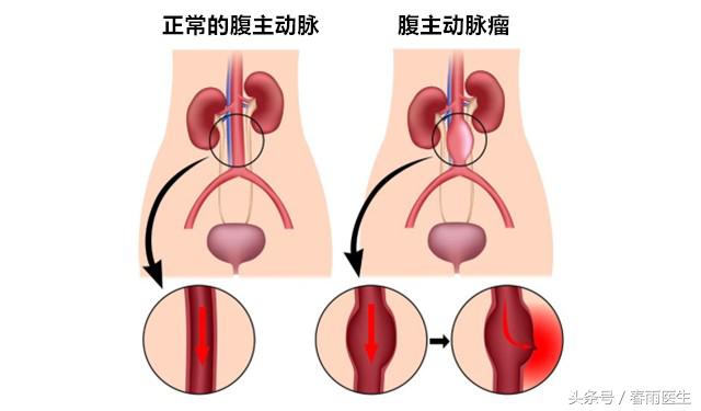 1000元30岁男性的最佳体检方案,29岁男性体检哪些项目比较合适