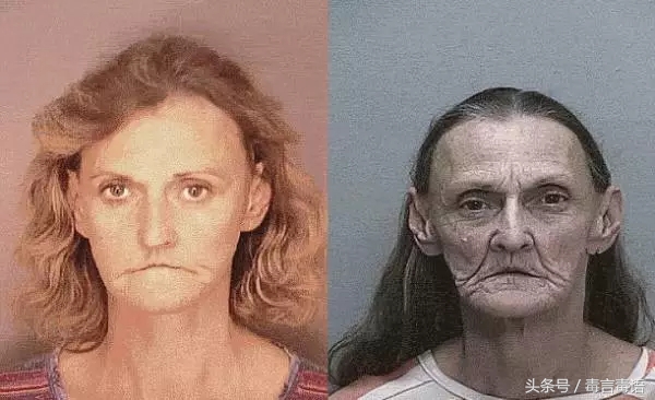 触目惊心吸毒前后真实的变化,吸毒的危害到底有多严重图片