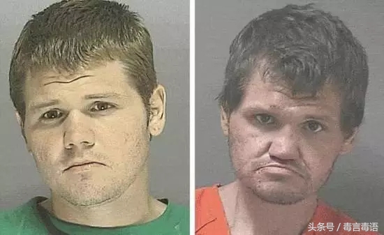 10个吸毒前后的惊人变化,吸毒的人吸毒前后对比图片