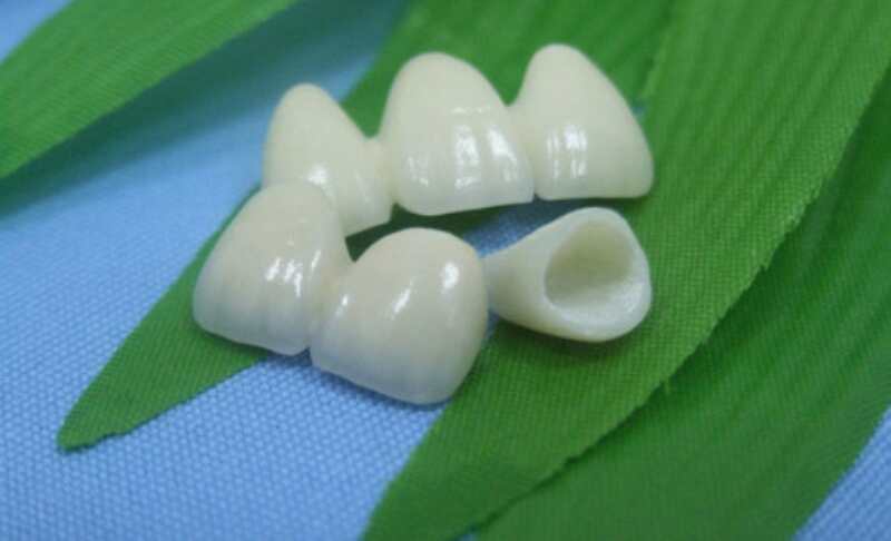 3d打印金属烤瓷制作流程与标准,3d打印氧化锆全瓷牙制作