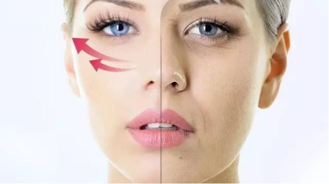 三十岁有法令纹可以做超声刀吗,做完脸部超声刀法令纹变明显了