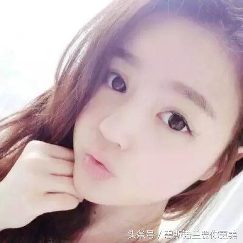 做了美瞳线双眼皮不见了,美瞳线做完1-7天肿胀的对比图