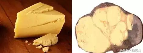 舌尖上的医疗,舌尖上的医疗篇