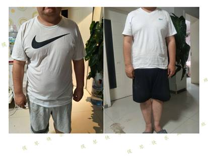 医学营养治疗减脂减重原理,医学营养减重门诊