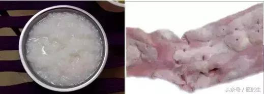 舌尖上的医疗,舌尖上的医疗篇