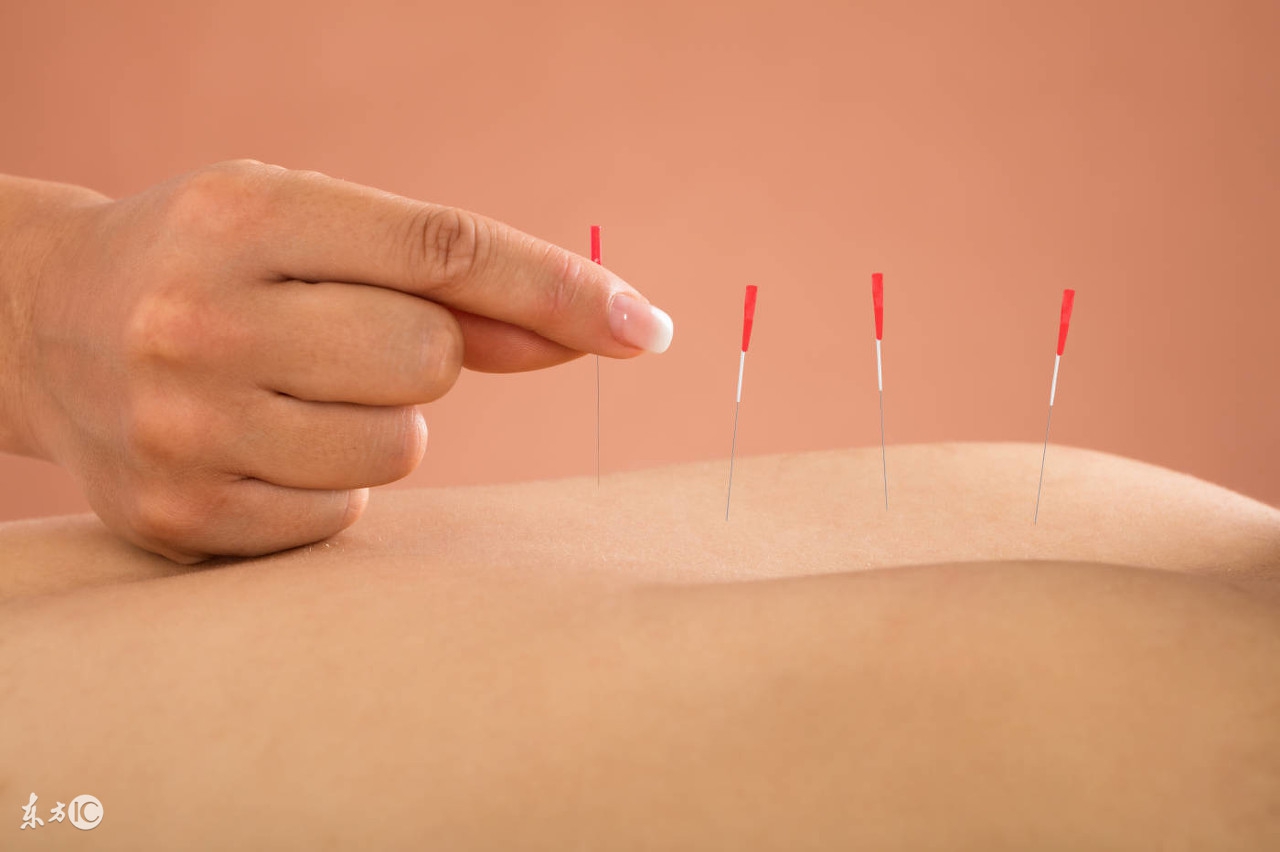 中医“萌新”的福利！针灸心得整理！