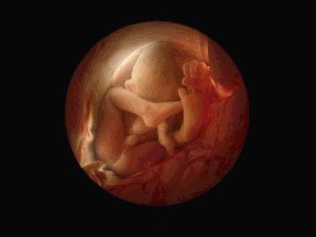 十三号染色体三体是母亲年龄大吗,孩子染色体异常会导致矮小吗