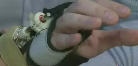 帕金森防震颤手套,帕金森手套