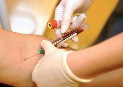 皮肤过敏查过敏源多少钱,皮肤过敏怎么测过敏源