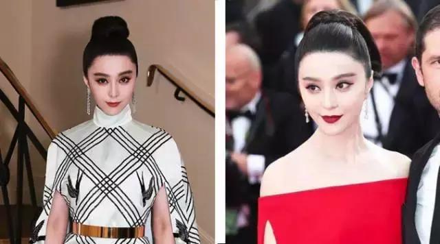 90后脱发的原因和治疗方法,中年脱发真的是一大考验