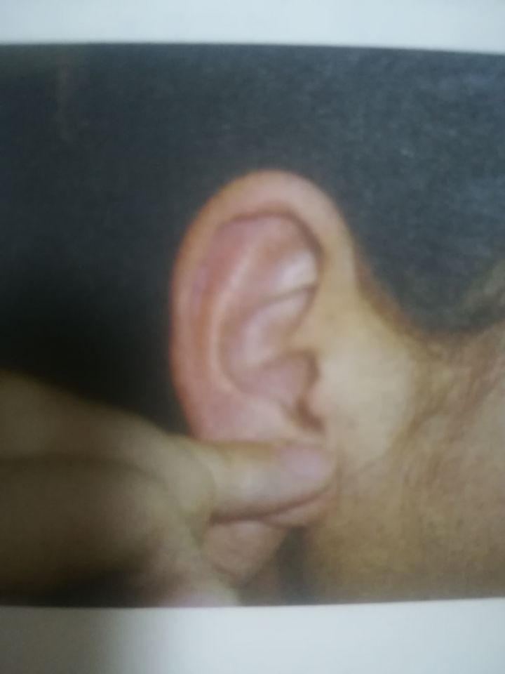 一学就会的观耳辨病法,观耳识病